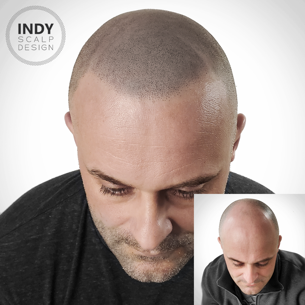 Indy Scalp Design